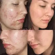 Alya Skin Ultimate Skincare Bundle