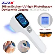 Handheld 308 Excimer For Skin Diseases 308nm UVB Light Therapy Equipment at Home