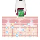 LED 540 Pins Microneedling Roller Vibration Painless Hair Growth Beard Skin NOW