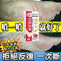 在飛比找蝦皮購物優惠-【常年頑固腳氣】日本腳氣噴霧香港腳噴劑腳臭噴霧腳臭粉足部止癢