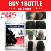 Hair Rescue Rx Women FIGHT HAIR LOSS REGROW HAIR INCREASE THICKNESS-90 Capsules