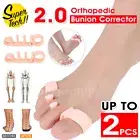 Bunion Corrector 2.0 Toe Separators Silicone Gel Elastic Straighteners Spacers