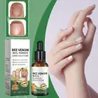 Nail Treatment Fungus Anti Fungal Toe Removal Care Infection Liquid Solution^`