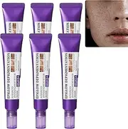 Epiglow Melanex Advanced Anti-Hyperpigmentation Cream, Retinol Face cream, Freckle Reduce Serum, Dark Spot Corrector for Face Body, Anti-Aging Skin Brightening Treatment for All Skin Types (6PCS)