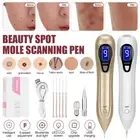LCD Laser Skin Tag Freckle Wart Dot Mole Remove Pen Dark Spot Tattoo Removal
