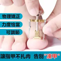 在飛比找蝦皮購物優惠-🎉現貨【凍甲矯正器】甲溝炎矯正器 不鏽鋼凍甲矯正器 矯正鉗 