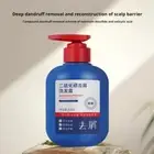 Anti-Dandruff Shampoo 300ml – Fast Relief' Fights & Itchy Scalp' Y2W9