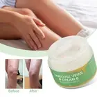 Pain Relief Legs Vasculitis Removal Varicose Veins Cream Spider Stretch Marks