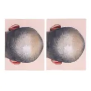 Man Bald Micropigmentattion Practice Skin Silicone Hairline Microblading Pra EUJ