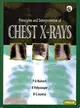 Principles and Interpretation of Chest X-Rays