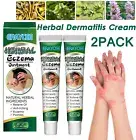 【2X】Natural Eczema Psoriasis Cream