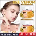 1/2/3PCS Bee-Venom Wart and Tag Remover Bee-Venom Mole & Wart Treatment-Cream