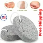 1pcs Natural Lava Pumice Stone for Feet Callus Remover , Asqraqo Pedicure Kit