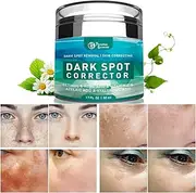 Dark Spot Remover For Face, Dark Spot Corrector Cream For Face Melasma, Freckle, Hyperpigmentation Treatment, Sun Spots for Men And Women