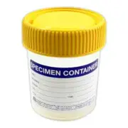 Urine Lab Specimen Containers Jars Cups Leak Proof Id Label Yellow Lid x 10