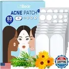 LitBear Large Acne Pimple Patches, 5 Sizes 80 Patches for Large Breakouts, Ac