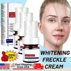 Whiting And Freckle Removing Serum Cream Dark Spot Removing Freckle Essence 1-5x