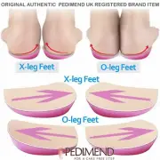 Pedimend Achilles Tendonitis Support O/X-Legs Insoles for Flat Feet Heel Spurs