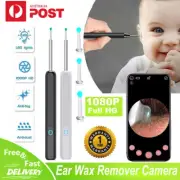 Wireless WiFi HD Ear Spoon Cleaner Otoscope Endoscope Ear Wax Remover Camera Kit