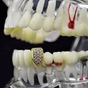 18K Gold Plated Single Cap Grillz CZ Slug Micro Pave Bling Bottom Canine Tooth