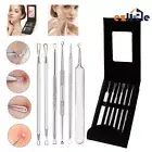 6Pcs Blackhead Whitehead Pimple Spot Comedone Extractor Remover Popper Tool Kit