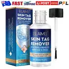 1-3X Fast Skin Tag Remover Instant Treatment Safe Wart Acne Removal Face Liquid