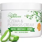Wild Naturals Eczema & Psoriasis Cream for Dry Itchy Skin – Eczema Relief Cre...