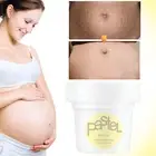 Stretch Marks Repair Cream Enhance Elastic Moisturizing Skin Tightening Safe BST
