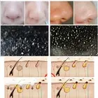 10PCS Nose Blackhead Remover Mask Deep Cleaning Shrink Pore Acne Treatment Ma SN