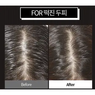 韓國 APIEU Oily Hair Dry Powder 急救頭髮控油蜜粉 5g (頭髮蜜粉)