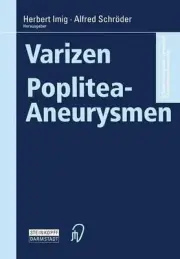 Varizen Poplitea-Aneurysmen by Herbert Imig (German) Paperback Book