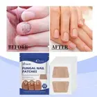 Toenail Fungus Extra Strength 8-Hour Nighttime Renewal Fungus' Toenail B1N8