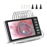 Digital Otoscope with 7-Inch Screen, Ear Camera, Visual Ear Scoop Supports8879