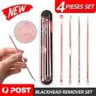 4pcs Blackhead Remover Tool Set Popper Comedone Pimple Blemish Acne Extractor