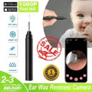 1080P Ear Wax Remover Camera Wireless Ear Endoscope Spoon Cleaning Otoscope KZ