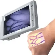 Vein Finder Viewer, Handheld LED Vein Finder with USB Cable, Vein Locator Detector, Vessel Imaging Instrument,Vascular Display Instrument for Nurse Clinics Homes Use