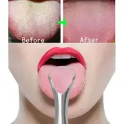Steel Tongue Scraper Metal Tongue Cleaner Dental Care HOT-NEW X9B8