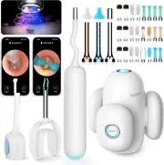 Bebird Home 30S Ear Camera System Ear Cleaner with Flexible Otoscope Camera UVC