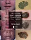 Barbara Leppard Richard Ashton Differential Diagnosis in Dermatology (Paperback)