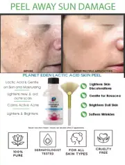 Purest Grade Lactic Acid Peel for DARK SPOTS, Sun Damage, Wrinkles & AGE SPOTS