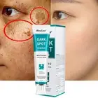 20ml Dark Spot Corrector Cream Whitening Freckle Cream Mild Ingredients