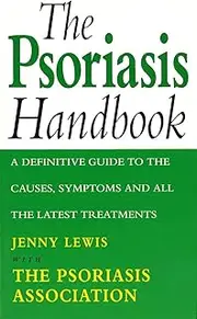 The Psoriasis Handbook: A Definitive Guide to the Causes,Symptoms and all the Latest Treatments
