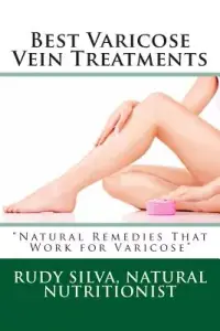 在飛比找博客來優惠-Best Varicose Vein Treatments: