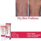 Natural Skin Treatment for Eczema Relief Psoriasis Skin Rashes Deep Moisturizer