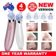 Face Facial Pore Blackhead Remover Vacuum Derma Suction Diamond Dermabrasion