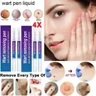4pcs Wart Remover Pen Skin Tag Mole Remover Eliminate Foot Corn Warts Unisex