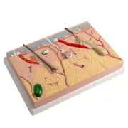 Anatomical Skin Model 3D Skin Teaching Model, Human Skin Anatomy Model