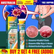 Genital Herpes Wart Remover Ointment Skin Tag Mole Acuminatum Treatment Cream