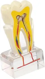 MAGICLULU Analysis Model Enlarged Teeth Model for Education Teaching Demonstration Communication Realistic Oral Simulation
