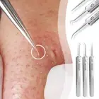 Acne Needle Blackhead Remover Kit Pimple Blemish Comedone Extractor Tweezer S8Y8